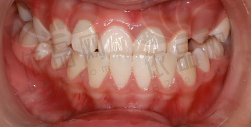 福州维乐口腔门诊部（中街亭总店）正规吗