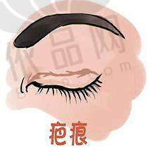 卢九宁医生擅长项目