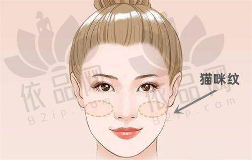 哈尔滨下颌角整形价格·下颌角修复