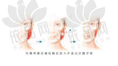 二、上海九院整复外科怎么样
