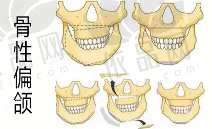 毛发移植项目特色