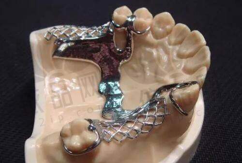 广州瑞德口腔医院张昌辉all - on - 4种植牙9970元起,凌诗青牙齿美白3280元起