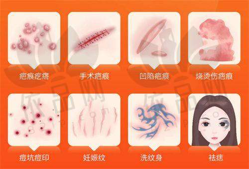 广州沃德医疗美容整形诊所自体耳软骨隆鼻、植发、双眼皮等项目价格及效果情况