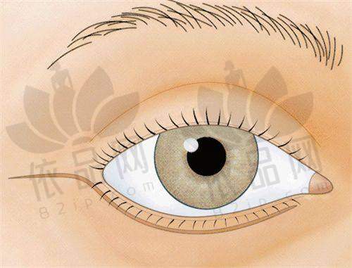 胸部整形及其他项目