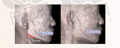 与其他医院的对比