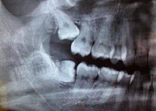 福州爱尚贝臣口腔门诊部营业时间