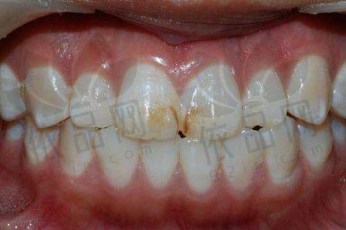 二、深圳格伦菲尔口腔矫正医生的技术水平