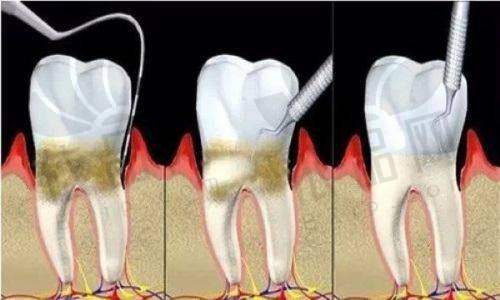 福州维乐口腔吴和峰医生预约方式