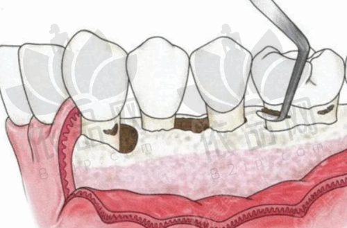 陈慧玲医生擅长项目