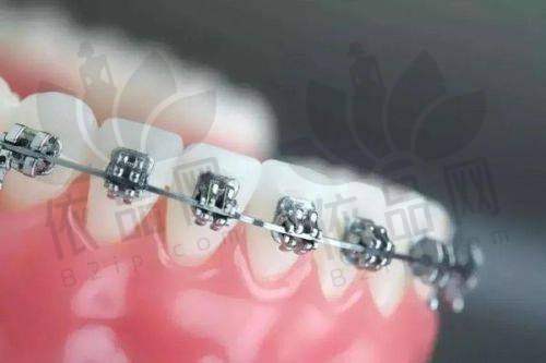 福州维乐口腔郭淑萍医生的口碑评价