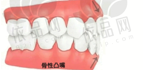 福州维乐口腔吴和峰医生擅长项目