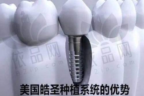 宣城市大医口腔医院曹志雄医生：特色技术优势