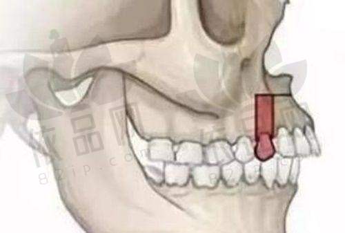 福州美可普口腔医院晋安总院正规吗