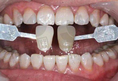 宣城市大医口腔医院曹志雄医生：擅长项目