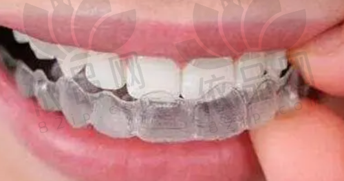 福州美可普口腔医院晋安总院交通路线