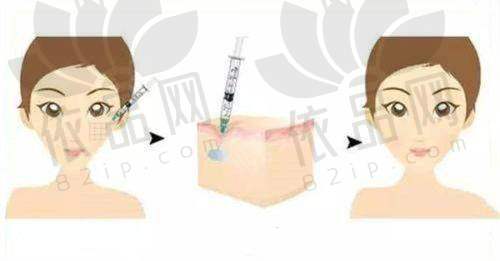 广州韩式千玺医疗美容门诊部双眼皮4980元起,隆鼻6800元起,多项医美价格实惠