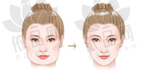 广州韩式千玺医疗美容门诊部2025年价格表