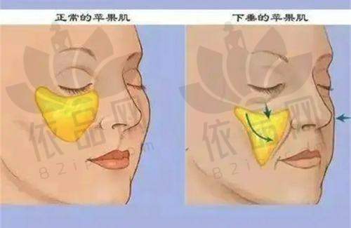 北京丽合岳莉冈医生 - 医疗技术特色优势