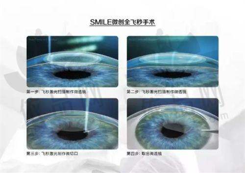 二、西安粉巷眼科医院预约挂号后就诊全流程指引