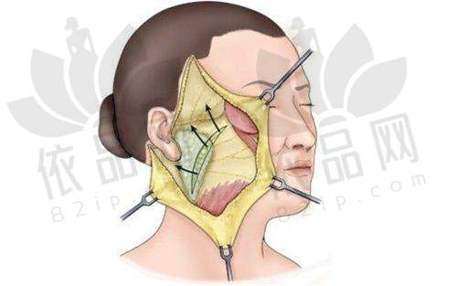 成都渼淳玉颜医疗美容隆鼻价格表