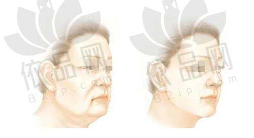 付晓慧医生口碑评价