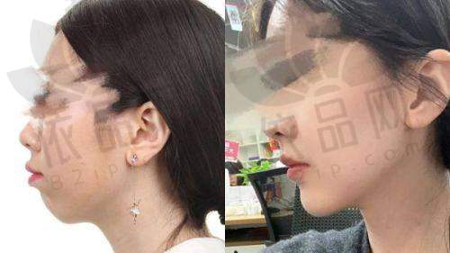 北京雅靓轻医美刘婷婷 - 医生预约方式