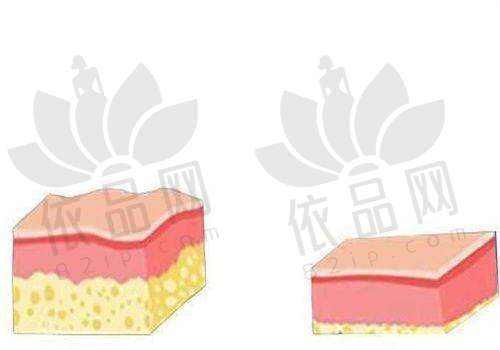 青岛博士医学美容医院怎么样