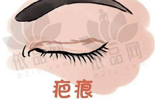青岛博士整形双眼皮价格