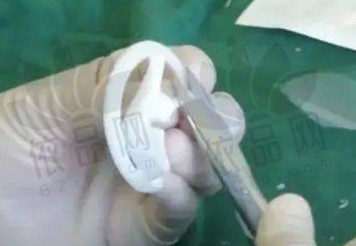 宋长绪医生特色技术优势