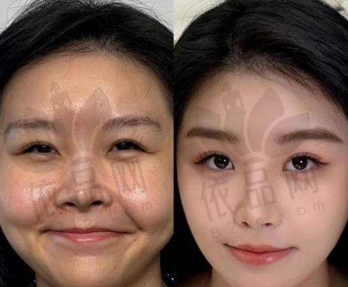 3、宁德华美医疗美容医院