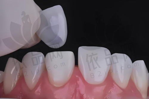 福州美可普口腔半口半固定种植牙仅1.8万起，韩国技术+专车接待，性价比超高