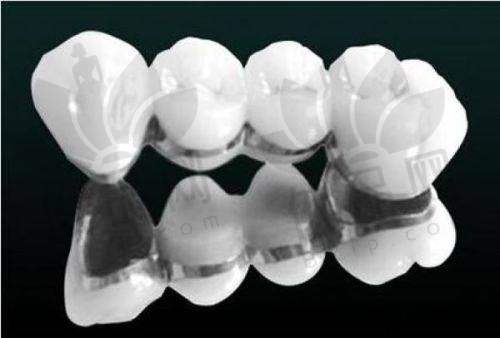 福州牙丽爱口腔树脂补牙的优势