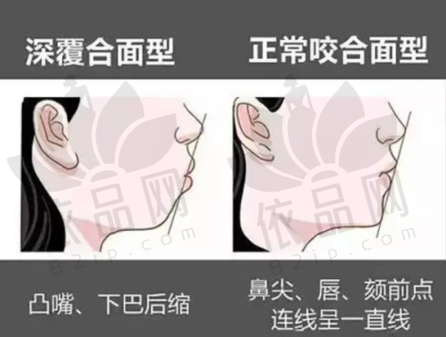 二、深圳尔睦口腔医院价格表