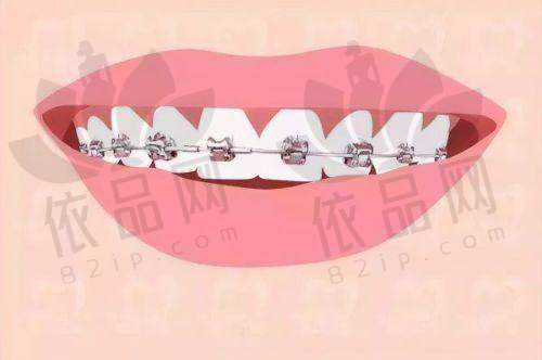 张兴医生——擅长项目