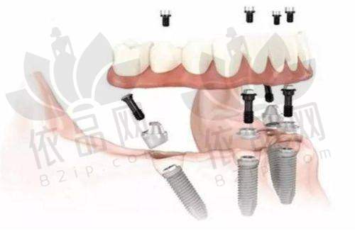 张兴医生——特色技术优势
