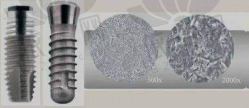 福州牙丽爱口腔林喜鹏医生特色技术优势