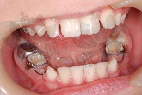 朱照鸿医生特色技术优势