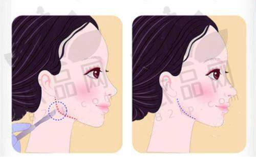 北京雅靓轻医美李哲医生 - 医生资质信息