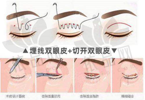 北京雅靓轻医美李哲医生 - 患者口碑评价