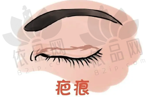 北京雅靓轻医美王佩蓉医生——擅长项目