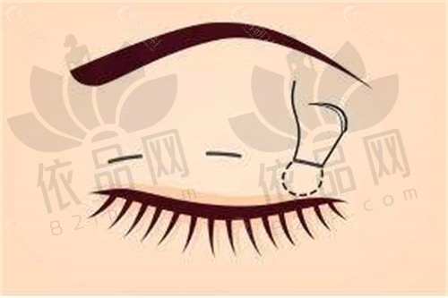 连凯峰医生预约方式