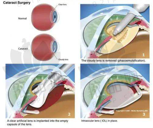 三、上海虹桥医院拇外翻治疗的收费情况