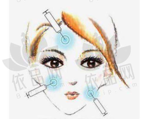 徐阳医生擅长项目