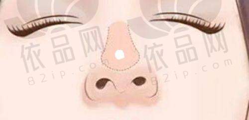 北京美莱医疗美容赵志力医生 - 擅长项目