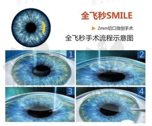 辛集复明眼科医院患者的满意度与口碑