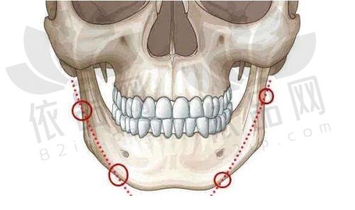 厦门思明美仑美奂医疗美容医院交通路线