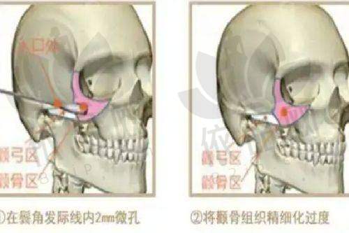 厦门脸博士整形外科门诊部收费价格表