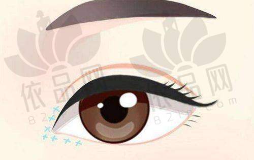 上海石彩霞双眼皮修复价格2025,对比上海九院、杜园园等医生价格及优势