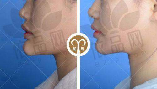 与其他整形医院对比优势