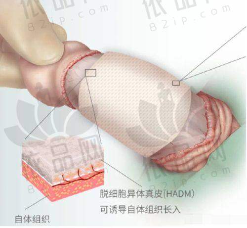 厦门欧菲医疗美容医院袁纯新口腔颌面手术价合理,多项医美术价格亲民效果好